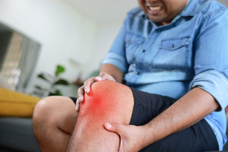 Asian man suffering from severe knee pain with red inflamed area. Concept of osteoarthritis,...