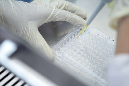 Researchers or chemists wear a glove holding 96 wells micro plate, transfer solution from...