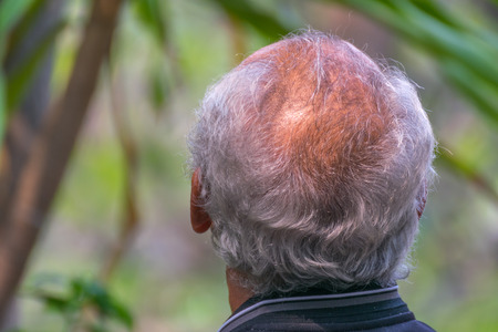 Bald head and  white hair asia adultの写真素材
