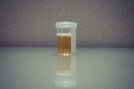 Urine sample testing in plastic bottle for examination in laboratory hospital , process in vintage...