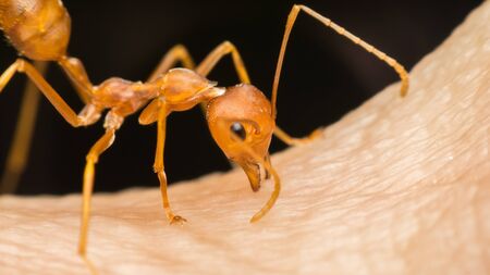 Macro of ant (Red Ant or Green Tree Ant) biting on the human skin for self-defense or self-protection from humanの写真素材