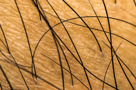 Macro of dry skin asian human with black hairy and pores on wrinkles skinの写真素材