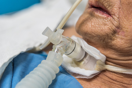 Patient asian elder women 80s do tracheostomy use ventilator for breathing help on bed in the hospital.