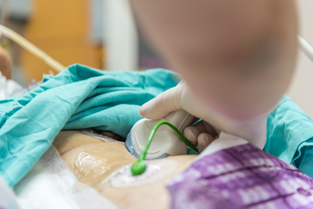 Patient asian elder women 80s do abdominal scan for diagnosis by doctor by use ultrasound device on a elderly patient abdomen on patient bed in intensive care unit (ICU.) room at hospital.の写真素材