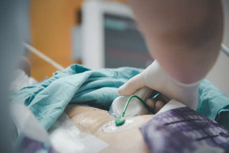 Patient asian elder women 80s ultrasound medical examination by ultrasound equipment use by doctor on bed in the hospital.の写真素材