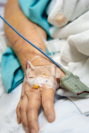 Patient asian elder woman 80s flu covid19 with pulse gauge for heartbeat measuring and blood pressure on a patient elderly finger on patient bed in intensive care unit (ICU.) room at hospitalの写真素材