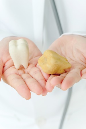 dentist holding molar,dental conceptの写真素材