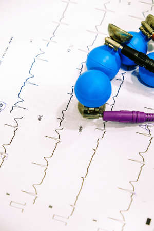 Close up Image of Electrocardiography backgroundの写真素材