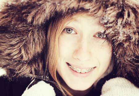 Teenage girl with braces smiling in the winterの写真素材