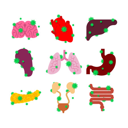 Sick internal organ set. Diseased Heart and brain. Liver and stomach. Esophagus and pancreas. Kidney and spleen. Lungs. Aching Viruses and bacteria. Human disease. ailingのイラスト素材