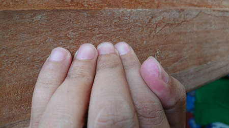 a photo of fingers, showing the nails.のeditorial素材