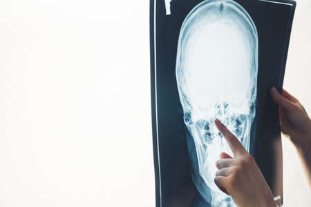doctor pointing on X-ray of head studio shot medical concept . High quality photoの写真素材