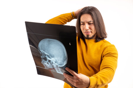 Young man holding and looking at head x-ray, touching head with his hand, sad emotions isolated studio shot copy space . High quality photoの写真素材