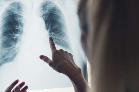 Finger touching chest x-ray skan. Professional analysis, healthcare concept. . High quality photoの写真素材