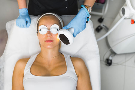 High angle headshot of a woman laying down during thermolifting skin treatment. Beauty concept. High...