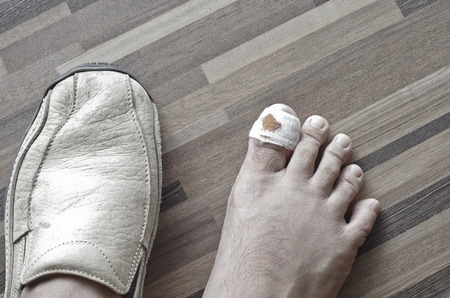 wound at my footの写真素材