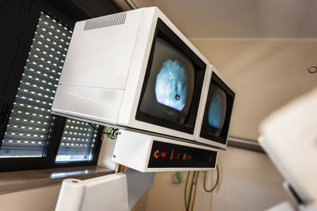 The lithotriptor attempts to break up kidney stones using an externally applied, focused, high-intensity acoustic pulseの写真素材