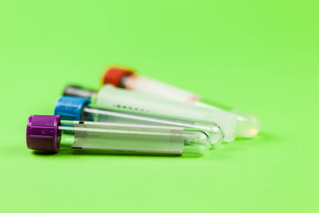 vacuum tubes for collecting blood samples in the lab