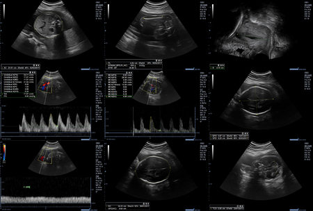 Collage of 9 ultrasonography fetus picturesの写真素材