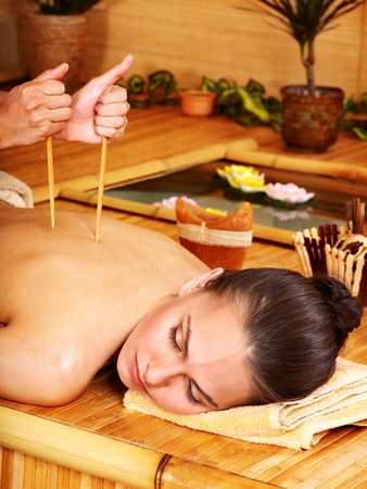 Young woman getting bamboo massage.の写真素材