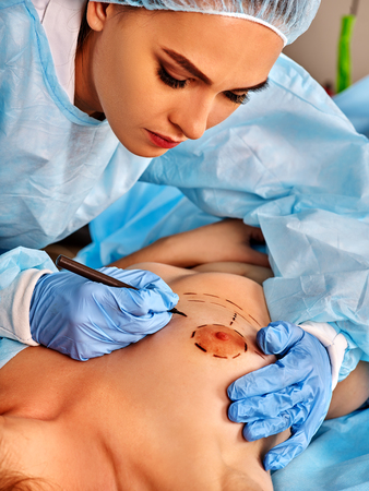 Augmentation breast cancer doctor surgery. Doctor makes dotted line on female body breast .の写真素材