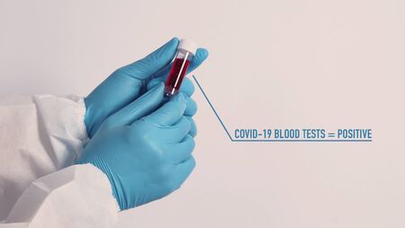 Blood tests in clear tube on doctor hands with blue medical gloves and PPE suit which represent...