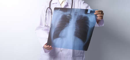 Asia woman doctor holding and checking up lungâ€™s x-ray film or radiograph from coronavirus...