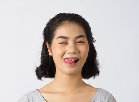 Dental brace beautiful girl smiling looking on a camera. white teeth with blue braces. Dental care. Asian teen woman smile with orthodontic accessories. Cosmetic dentistry, orthodontics treatment. white background studio.の写真素材