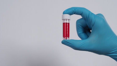 Blood tube. Covid 19 Test. doctor hand holding a blood sample tube for analysis in the lab...