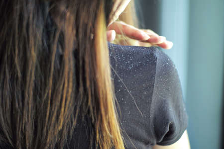 Rear view of woman having the dandruff on the shoulderの写真素材