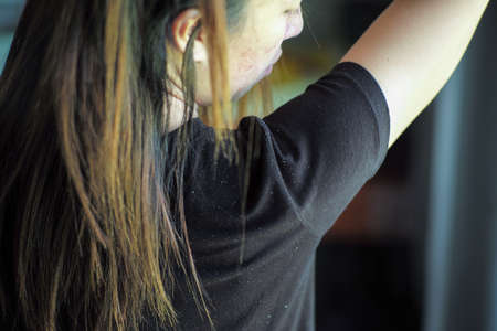 Rear view of woman having the dandruff on the shoulder. Acne on female faceの写真素材