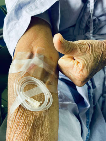 Extension Tube  for peripheral venous cannulation on the arm of an elderly patient