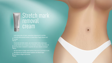 Stretch Mark Removal Cream. Skin Care Advertising Template. EPS10 Vectorのイラスト素材