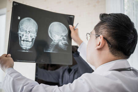 Close up of doctor holding x-ray, x-ray film of patient at hospital.の写真素材