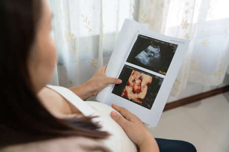 Asian young pregnant woman looking at ultrasound image, x-ray pregnant.の写真素材