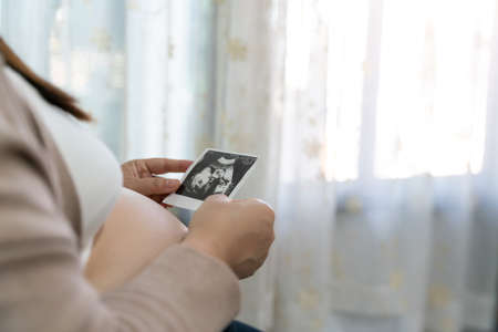 Pregnant woman holding ultrasound report at home. Mature lovely pregnant woman looking at sonogram image of her baby. x-ray pregnant.の写真素材