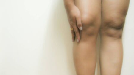 Blurry knee pain due to obesity.の写真素材