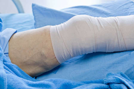 man with a leg wound, lying on the bed.の写真素材