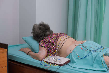 Asian elderly woman is receiving electric acupuncture treatment for her back and hip pain in hospital roomの写真素材
