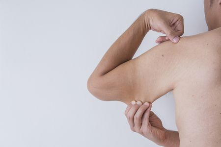 Check fat in the arms of  men fat.の写真素材