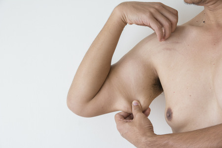 Check fat in the arms of  men fat.の写真素材