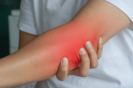 Close-up of an inflamed left elbow with redness. A hand gently touches the area, indicating tenderness, while the soft indoor background draws attention to the injury site.の写真素材