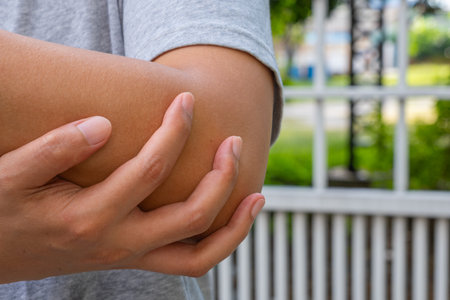 Asian man holds sore elbow after workout, indicating joint strain or inflammation. Outdoor fence and greenery suggest natural recovery and wellness.の写真素材