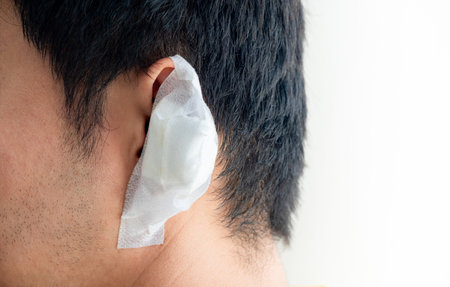 Ear wound, Side view of the left hand ear of a men with white bandage or plaster covered on the wound with surgery from accident or treatment , Healthcare and medical concept. isolated and copy spaceの写真素材