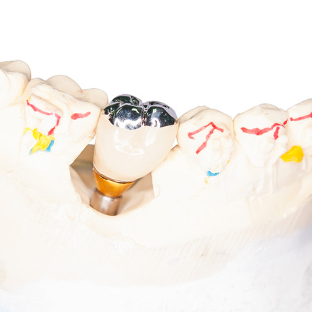 Dental Prothetic laboratory, technical shots on white background の写真素材