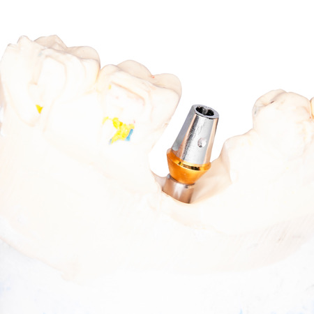 Dental Prothetic laboratory, technical shots on white background の写真素材