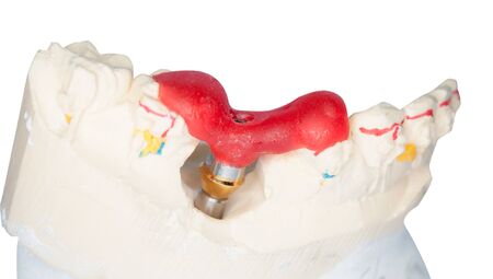 Dental Prothetic laboratory, technical shots on white background.の写真素材