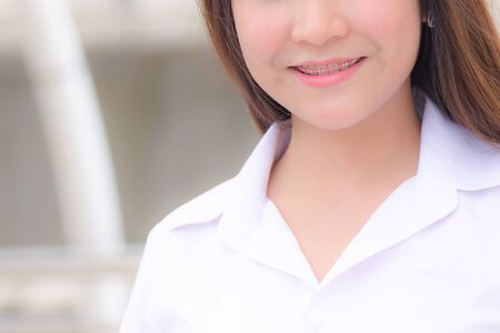 braces and white teeth of smiling girlの写真素材