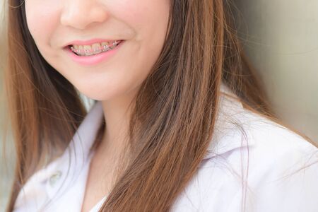 braces and white teeth of smiling girl