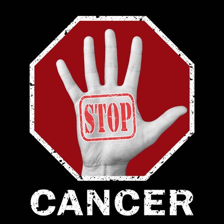 Stop cancer conceptual illustration. Open hand with the text stop cancer. Global social problemの写真素材